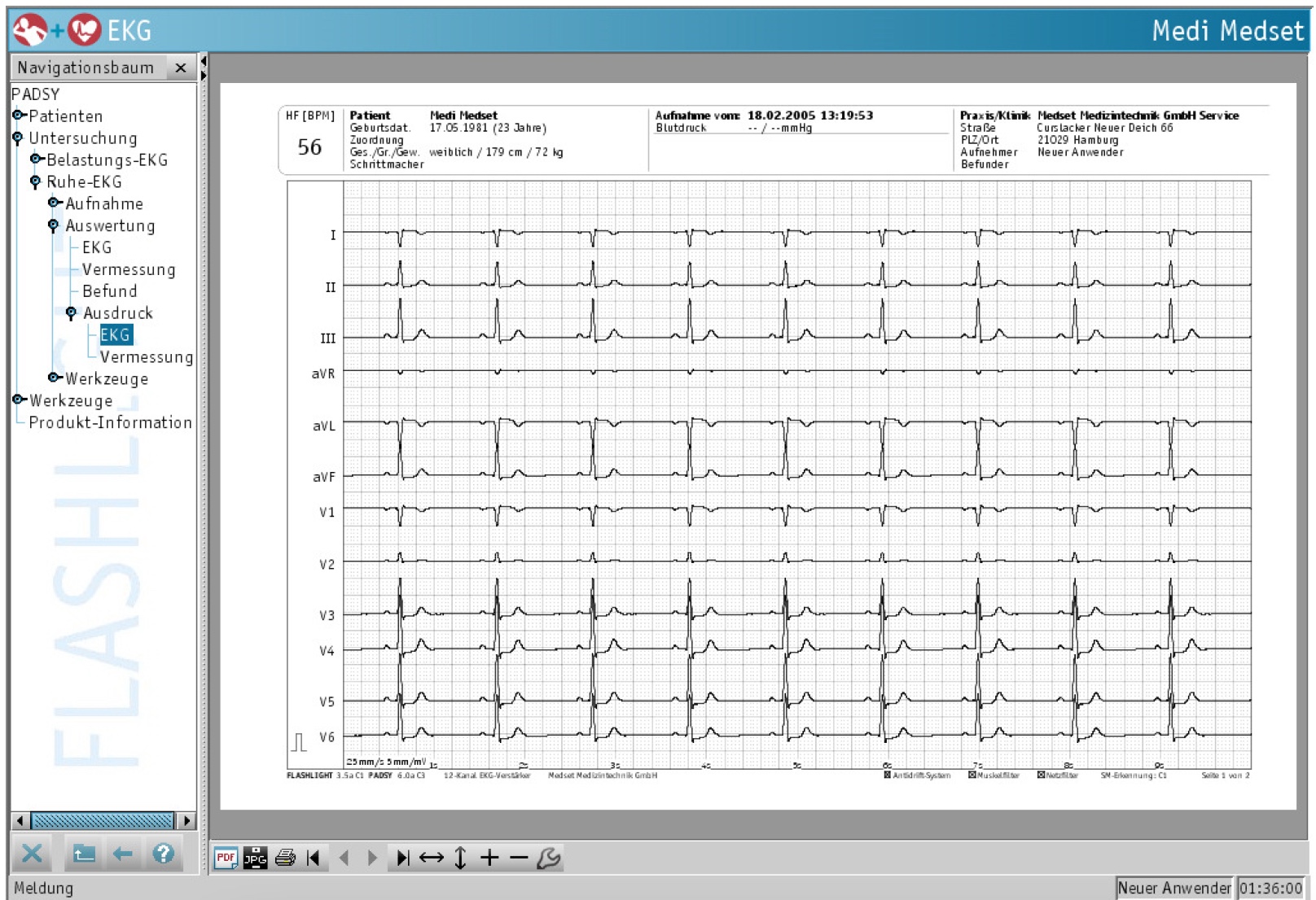 EKG-Ausdruck EKG-Ausdruck