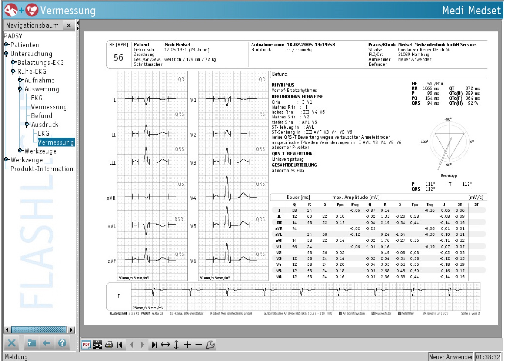 EKG-Auswertung