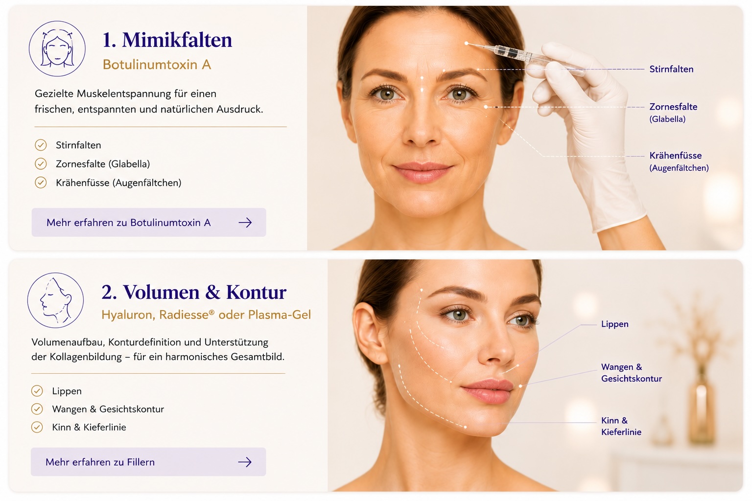 Kachel Mimikfalten & Volumen