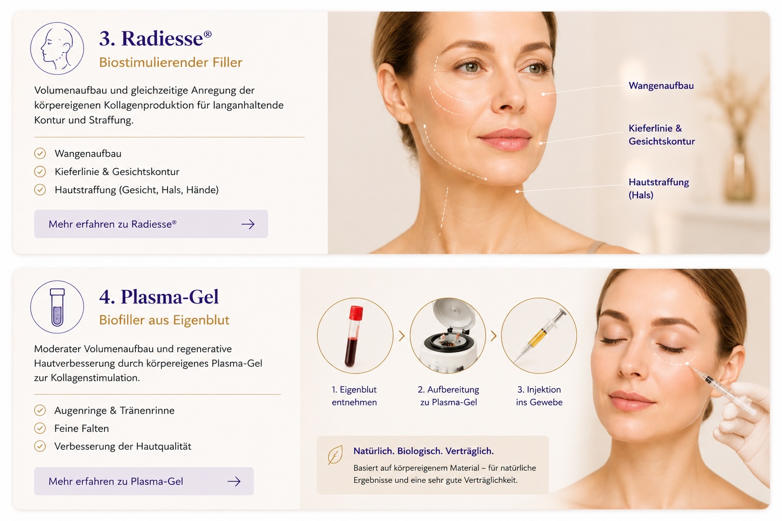 Kachel Radiesse & Plasma-Gel